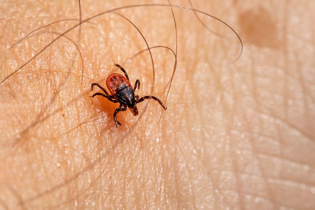 Close-up of a tick embedded in human skin