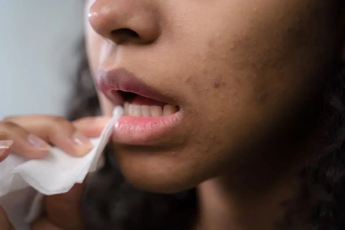woman-dabbing-lips-tissue-closeup