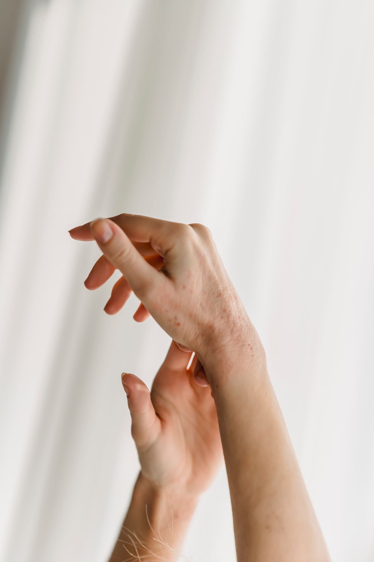 Close-up of a hand showing a rash or skin irritation on the wrist and back of the hand
