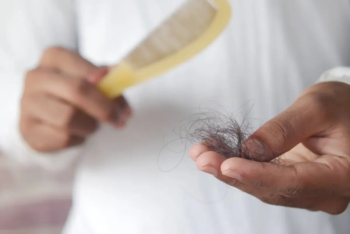hair-loss-strands-in-hand-comb